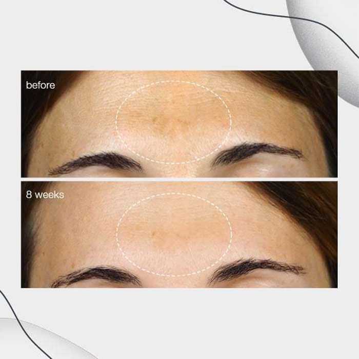 111404.e - Soma Laser - Skincare clinic - Pretoria - Customised skin and hair treatments. Stockists of Dermalogica, Lamelle, MD Lash Factor and Heliocare